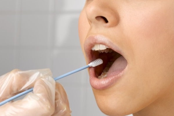 Afname van wangslijmvlies met een swab